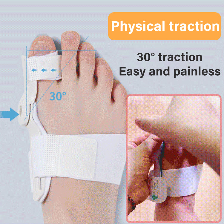 (1 комплект от 2 части) Коректор за пръсти Идеален за коригиране на пръсти, Hallux Valgus, чуковидни пръсти и подравняване на пръстите! (Приложимо тегло 40~80 kg)